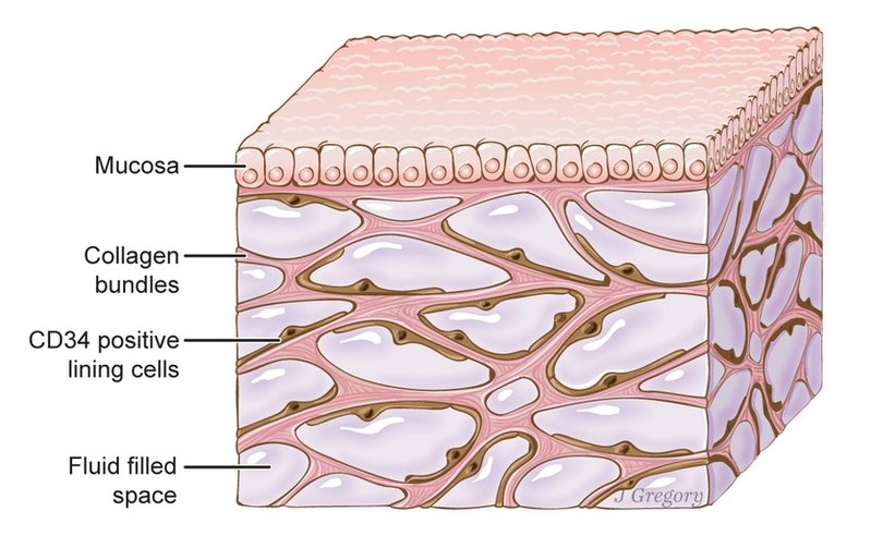 Illustration by Jill Gregory. Printed with permission from Mount Sinai Health System, licenced under CC-BY-ND. (https://creativecommons.org/licenses/by-nd/4.0/legalcode).